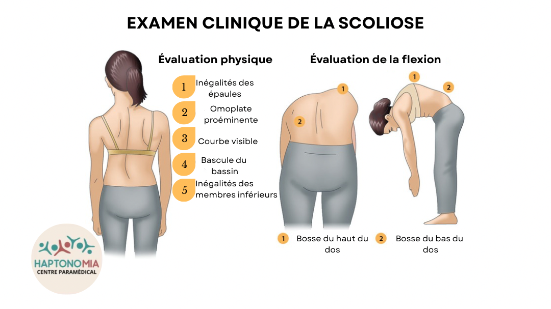 Examen clinique de la scoliose
