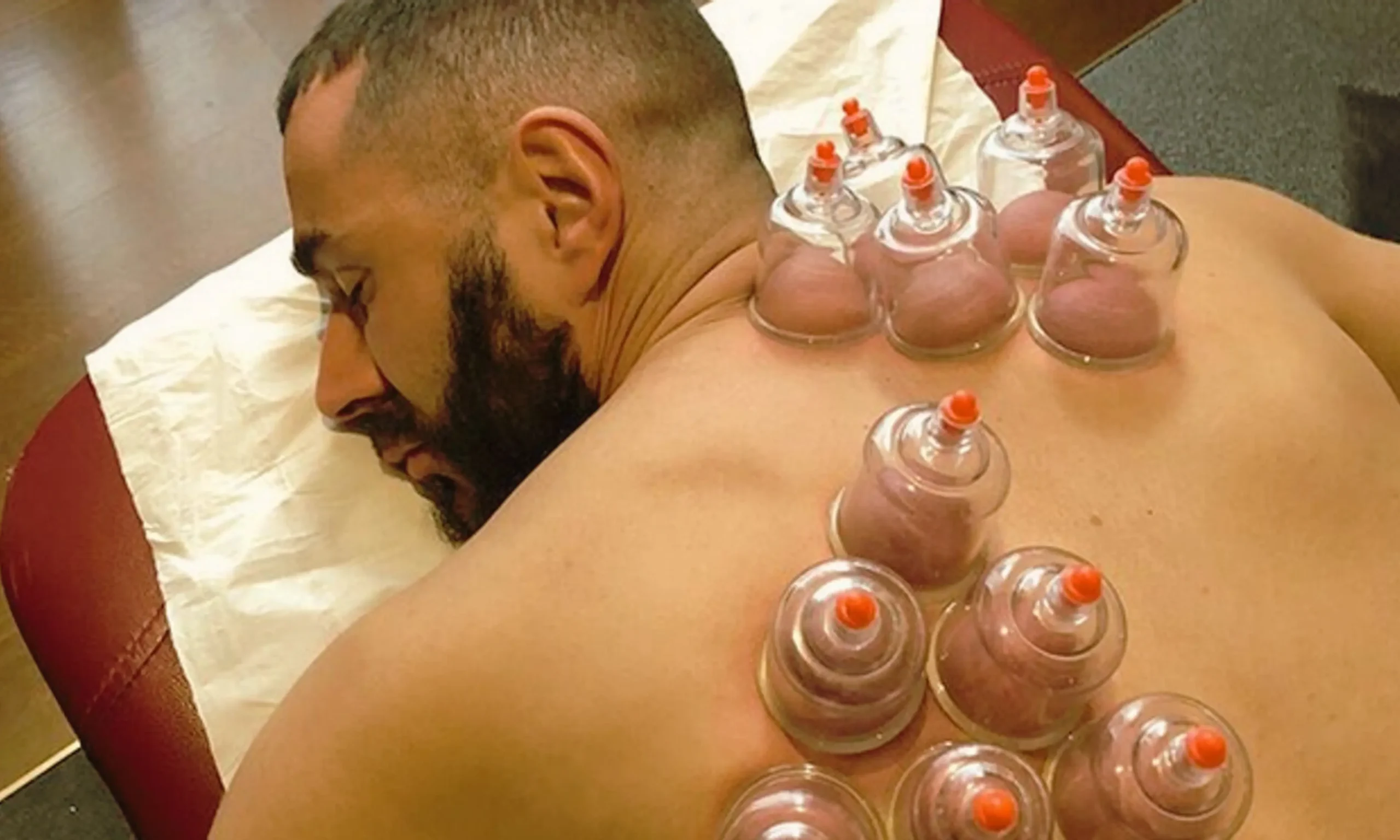 Séance de HIJAMA