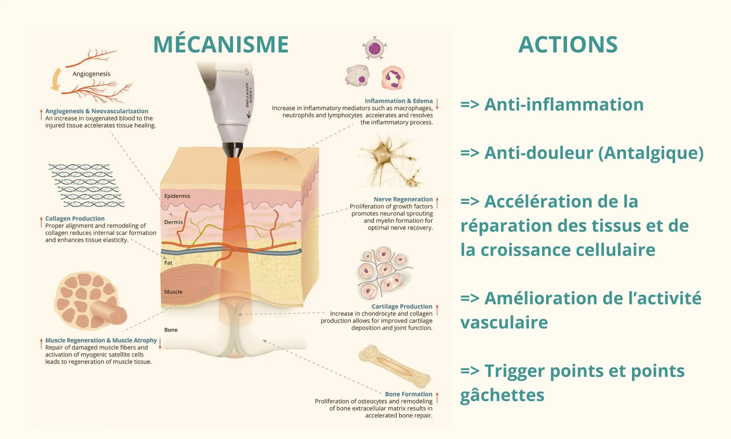 Les bienfait du traitement laser